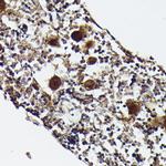 PF4 Antibody in Immunohistochemistry (Paraffin) (IHC (P))