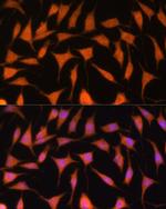 TIMM44 Antibody in Immunocytochemistry (ICC/IF)