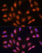 TIMM44 Antibody in Immunocytochemistry (ICC/IF)