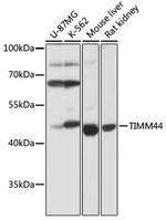 TIMM44 Antibody in Western Blot (WB)