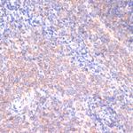 PIK3R2 Antibody in Immunohistochemistry (Paraffin) (IHC (P))