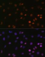 H2BK5me1 Antibody in Immunocytochemistry (ICC/IF)