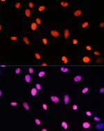 H2BK5me1 Antibody in Immunocytochemistry (ICC/IF)