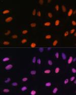 H2BK5me1 Antibody in Immunocytochemistry (ICC/IF)