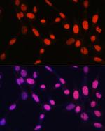 H2BK5me1 Antibody in Immunocytochemistry (ICC/IF)