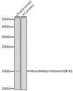 H2BK5me1 Antibody in Western Blot (WB)