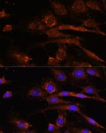 AP3S2 Antibody in Immunocytochemistry (ICC/IF)