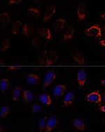 AP3S2 Antibody in Immunocytochemistry (ICC/IF)