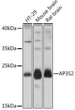 AP3S2 Antibody in Western Blot (WB)