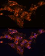 TMED2 Antibody in Immunocytochemistry (ICC/IF)