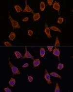 TMED2 Antibody in Immunocytochemistry (ICC/IF)