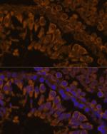 ZPBP Antibody in Immunohistochemistry (Paraffin) (IHC (P))