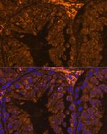 ZPBP Antibody in Immunohistochemistry (Paraffin) (IHC (P))