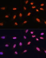 BAZ2A Antibody in Immunocytochemistry (ICC/IF)