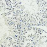 BAZ2A Antibody in Immunohistochemistry (Paraffin) (IHC (P))