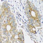 CLCC1 Antibody in Immunohistochemistry (Paraffin) (IHC (P))