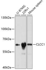 CLCC1 Antibody in Western Blot (WB)