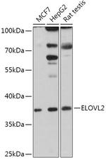 ELOVL2 Antibody in Western Blot (WB)