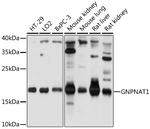 GNPNAT1 Antibody in Western Blot (WB)