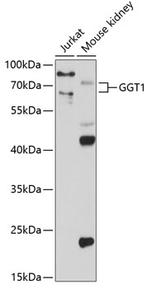 GGT1 Antibody in Western Blot (WB)