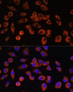 PIGM Antibody in Immunocytochemistry (ICC/IF)