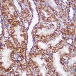 PIGM Antibody in Immunohistochemistry (Paraffin) (IHC (P))