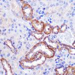 PIGM Antibody in Immunohistochemistry (Paraffin) (IHC (P))