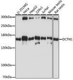 Dynactin 1 Antibody in Western Blot (WB)