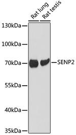 SENP2 Antibody in Western Blot (WB)