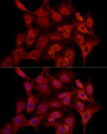 MCL-1 Antibody in Immunocytochemistry (ICC/IF)