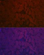 NNMT Antibody in Immunohistochemistry (Paraffin) (IHC (P))