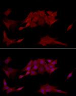 PTPN2 Antibody in Immunocytochemistry (ICC/IF)