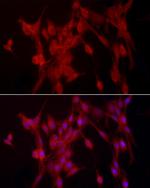 PTPN2 Antibody in Immunocytochemistry (ICC/IF)