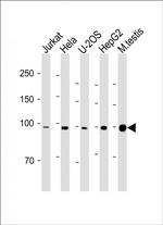 BAP1 Antibody in Western Blot (WB)