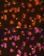 Fyn Antibody in Immunocytochemistry (ICC/IF)