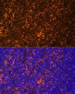 Fyn Antibody in Immunohistochemistry (Paraffin) (IHC (P))