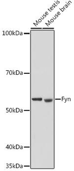 Fyn Antibody in Western Blot (WB)