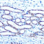 TBCCD1 Antibody in Immunohistochemistry (Paraffin) (IHC (P))