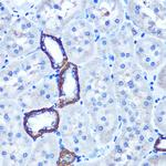 TBCCD1 Antibody in Immunohistochemistry (Paraffin) (IHC (P))