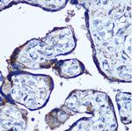 TBCCD1 Antibody in Immunohistochemistry (Paraffin) (IHC (P))