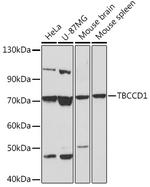 TBCCD1 Antibody in Western Blot (WB)