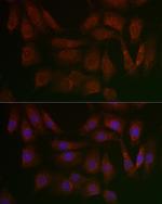 PERK Antibody in Immunocytochemistry (ICC/IF)