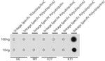 Ub-K11 Antibody in Dot Blot (DB)