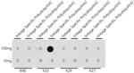 Ub-K33 Antibody in Dot Blot (DB)