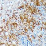 IER5 Antibody in Immunohistochemistry (Paraffin) (IHC (P))