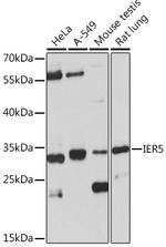 IER5 Antibody in Western Blot (WB)