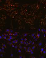 IFNAR1 Antibody in Immunocytochemistry (ICC/IF)