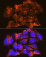 IFNAR1 Antibody in Immunocytochemistry (ICC/IF)