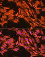 PKM2 Antibody in Immunocytochemistry (ICC/IF)