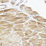 PKM1 Antibody in Immunohistochemistry (Paraffin) (IHC (P))